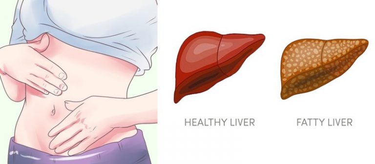 6 WARNING SIGNS THAT INDICATE YOUR LIVER IS FULL OF TOXINS