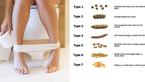 A quick glance in the toilet can tell you if you are healthy!