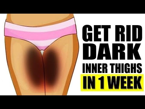 HOW TO LIGHTEN DARK INNER THIGHS, BIKINI AREA & BUTT