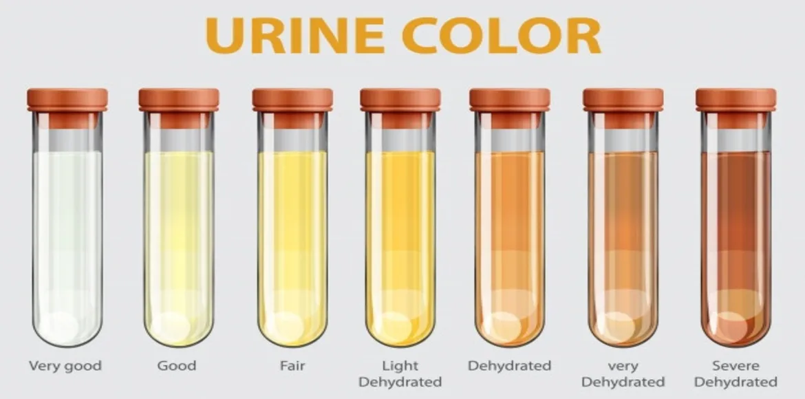 What The Color Of Your Urine Says About Your Health