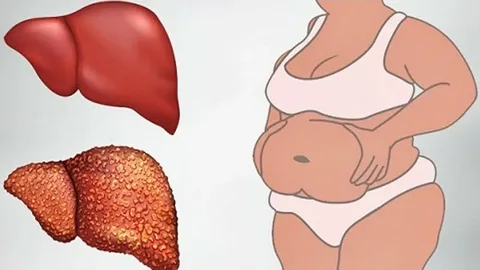 6 warning signs that your liver is full of toxins