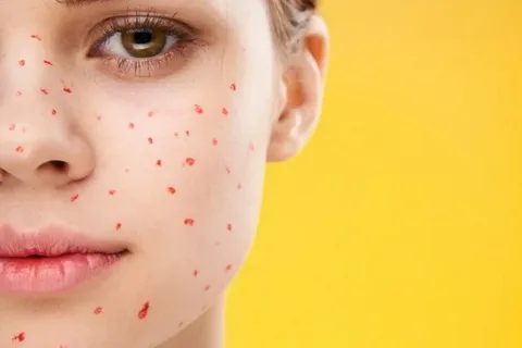 What do these red dots on your skin mean?