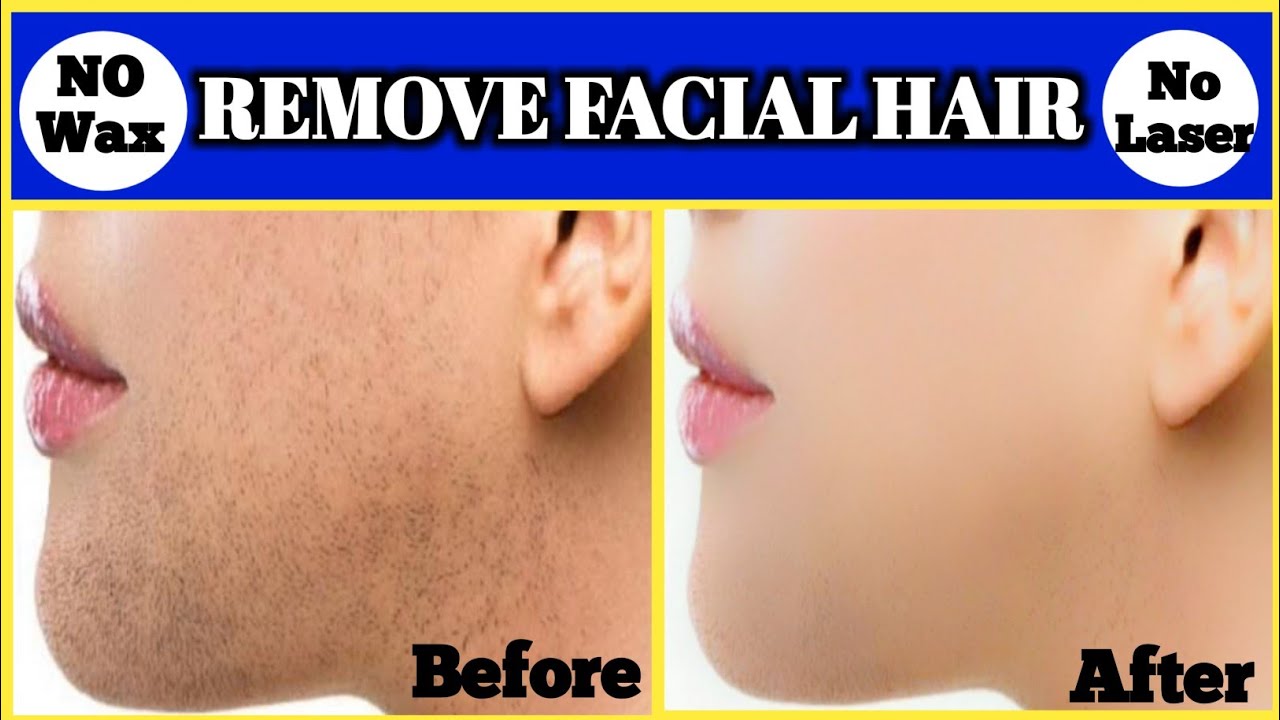 Remove Unwanted Hair Permanently in Three Days: No Shave, No Wax